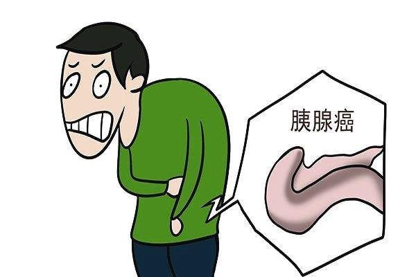 福州中医肿瘤：胰腺癌的典型症状
